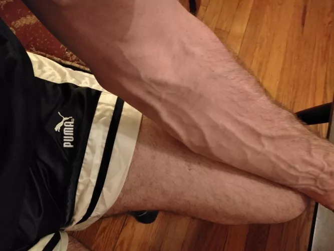 Phlebotomists always make comments.