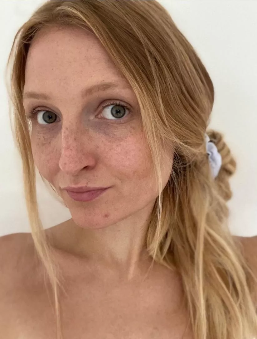 I have freckles all over my body..