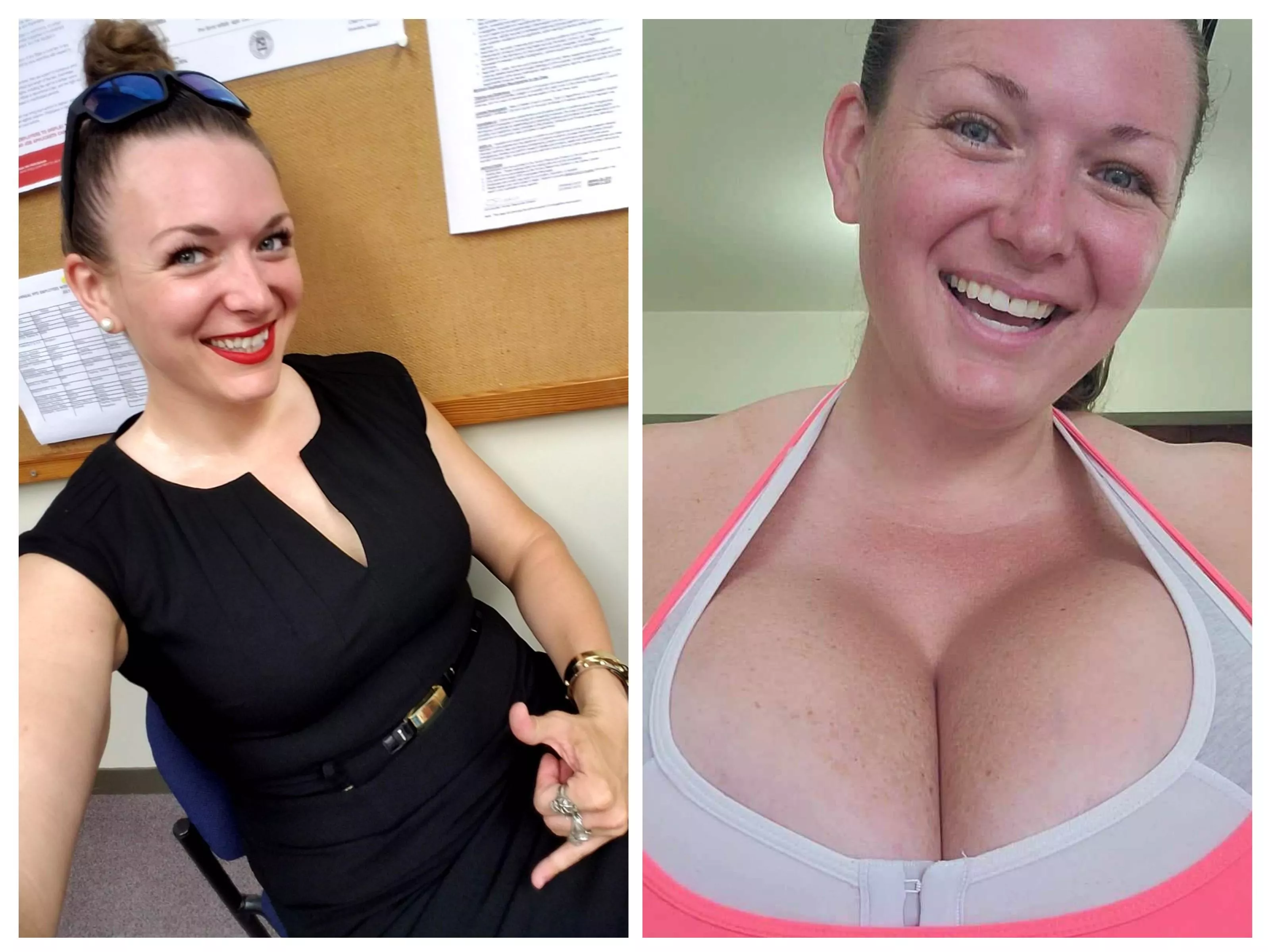 10 years ago I got diagnosed with a rare genetic disorder that caused later in life breast growth. Funny thing is they are still growing!!! 38KKK and growing!!!!