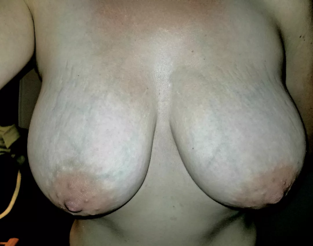 Big tits veins and stretch marks... love them