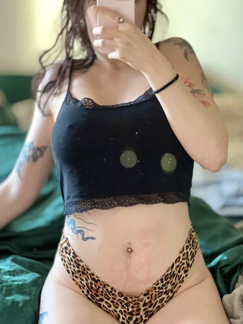 Woke up with an interesting water bottle burn mark [f]