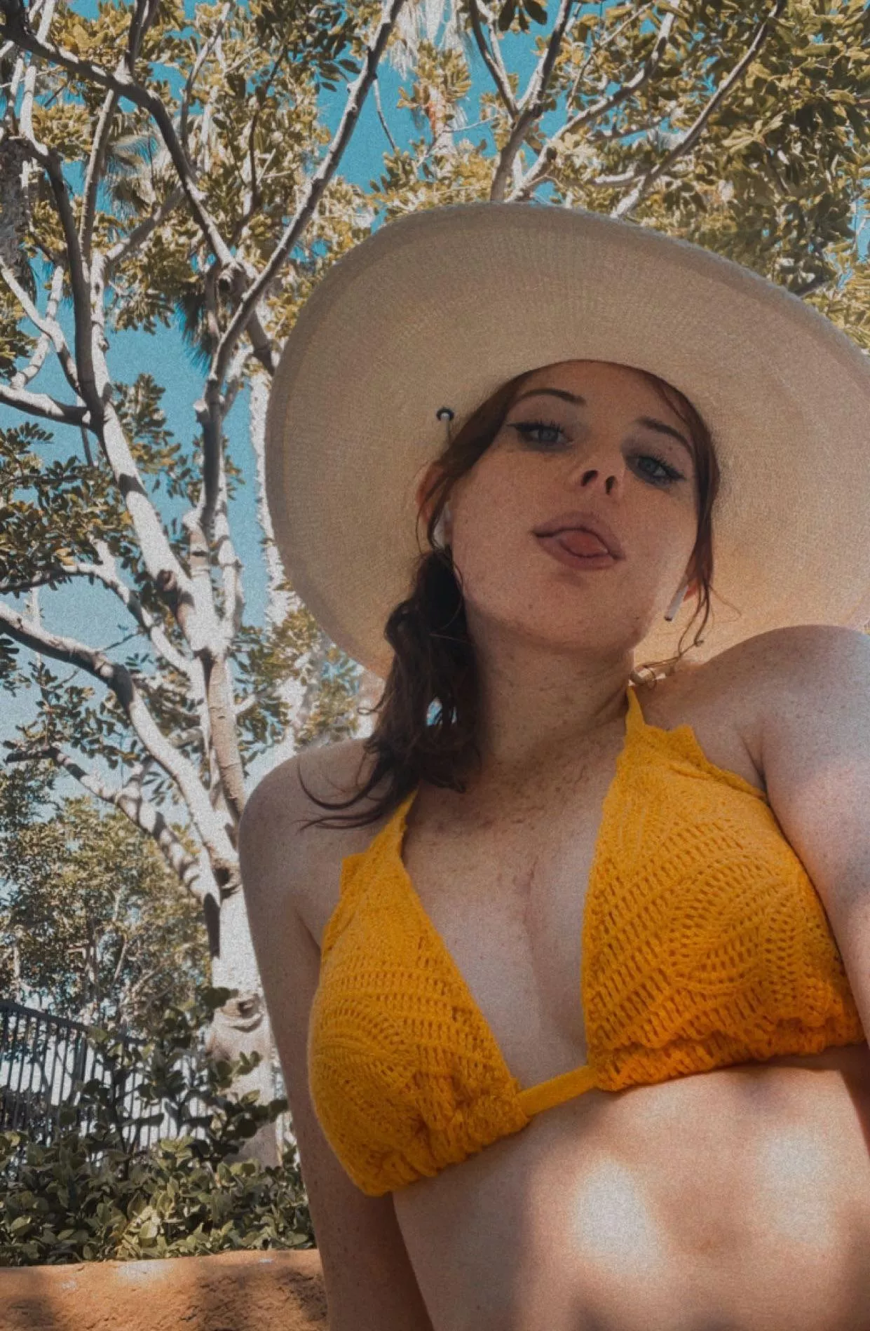 I don’t tan, I collect more freckles 😋 [f]