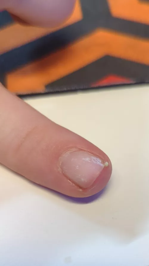 Felt a little pressure and I OOP