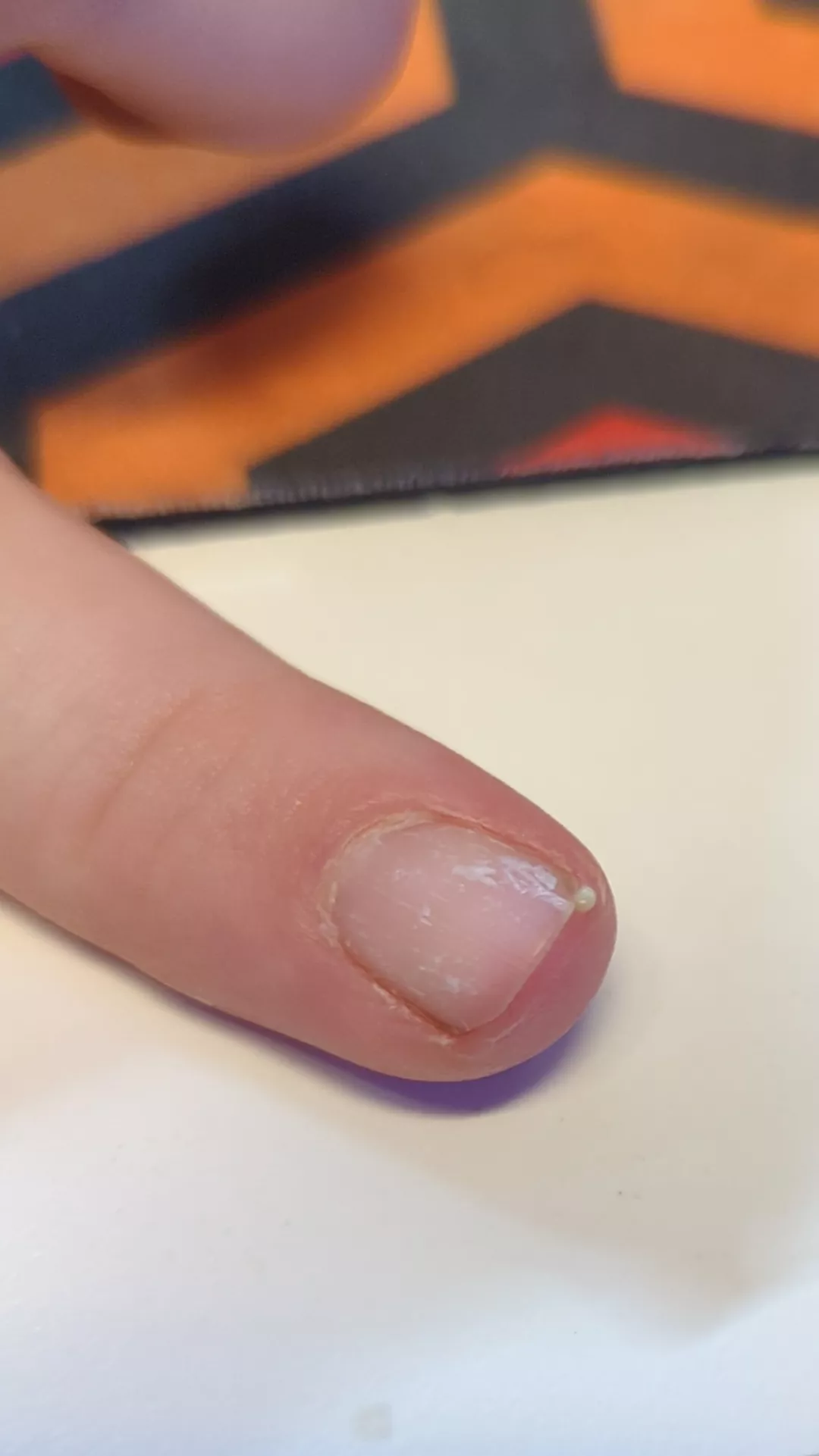 Felt a little pressure and I OOP