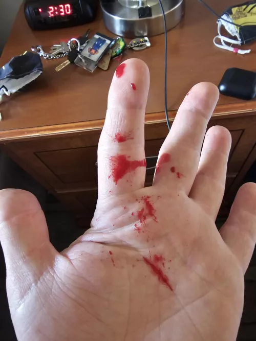 Had an absolute gusher on my thigh today