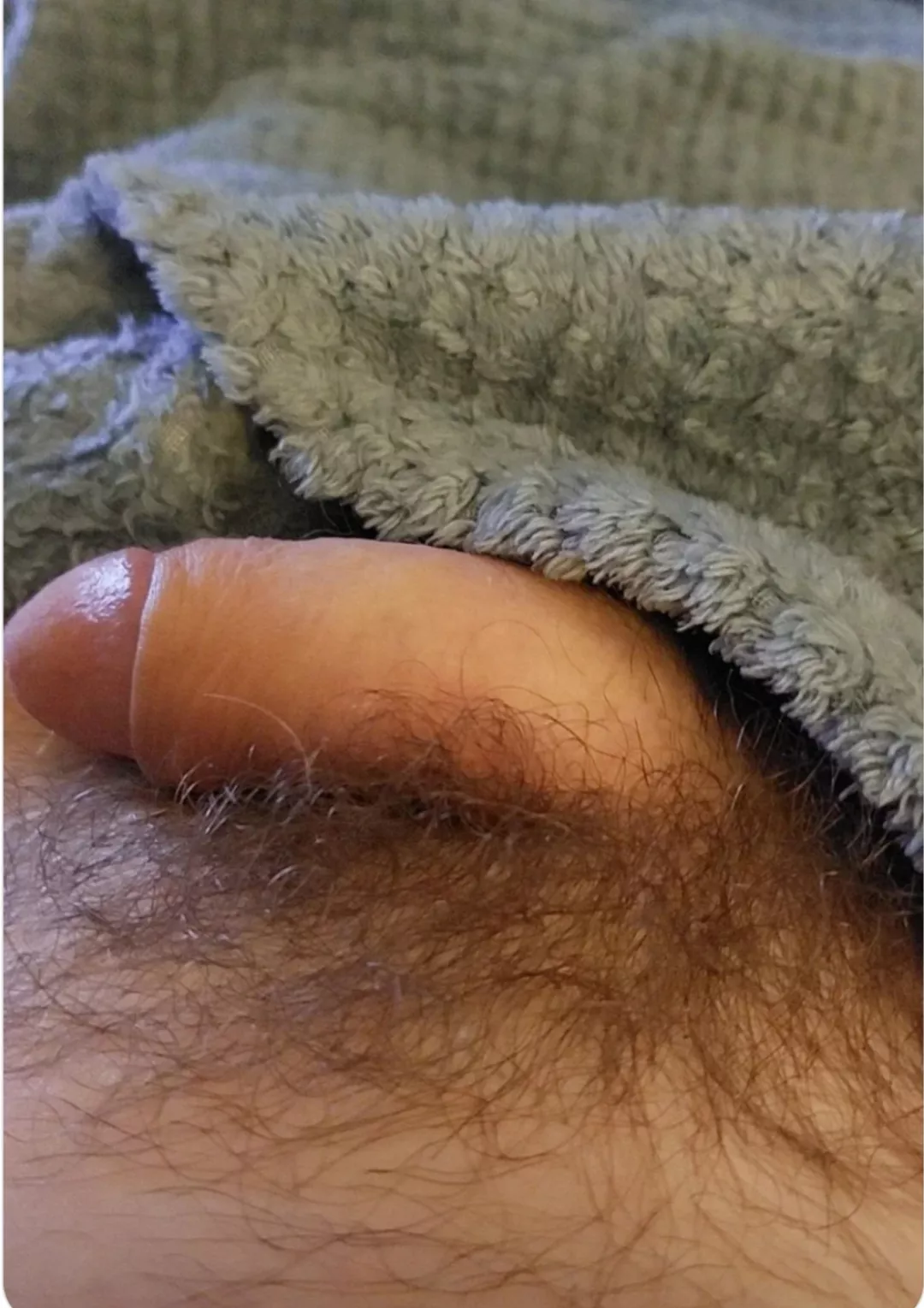 My softie. 9 months into restoring my foreskin; the glans is starting to dekeratinise, and sensation is incredible!