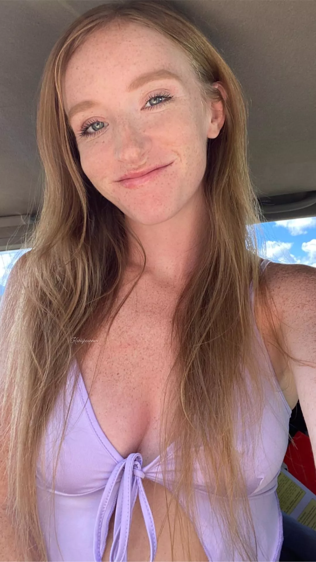 Would you kisss allllllll my freckles