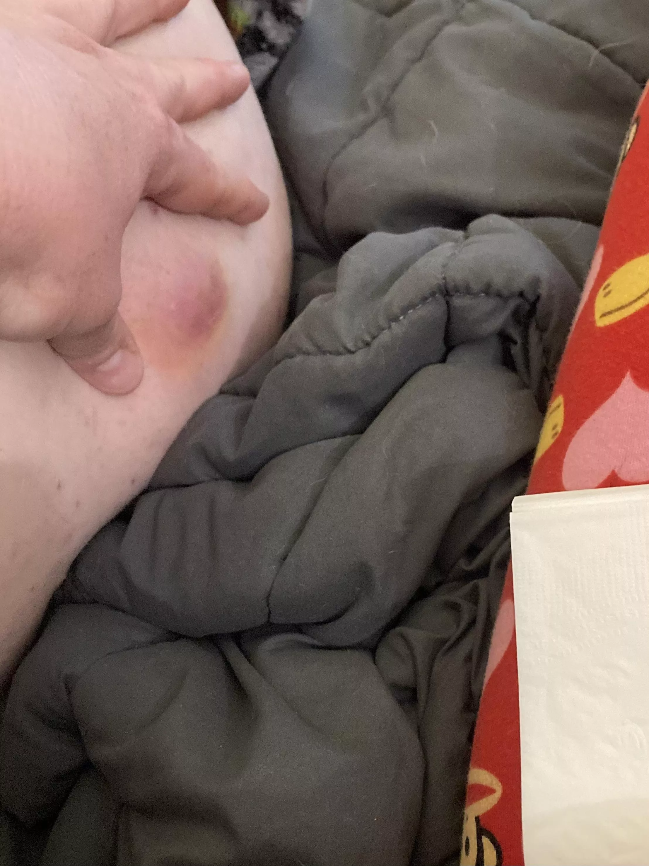 A bump on my hubs behind OC