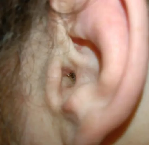 I've been an avid popper my whole life.