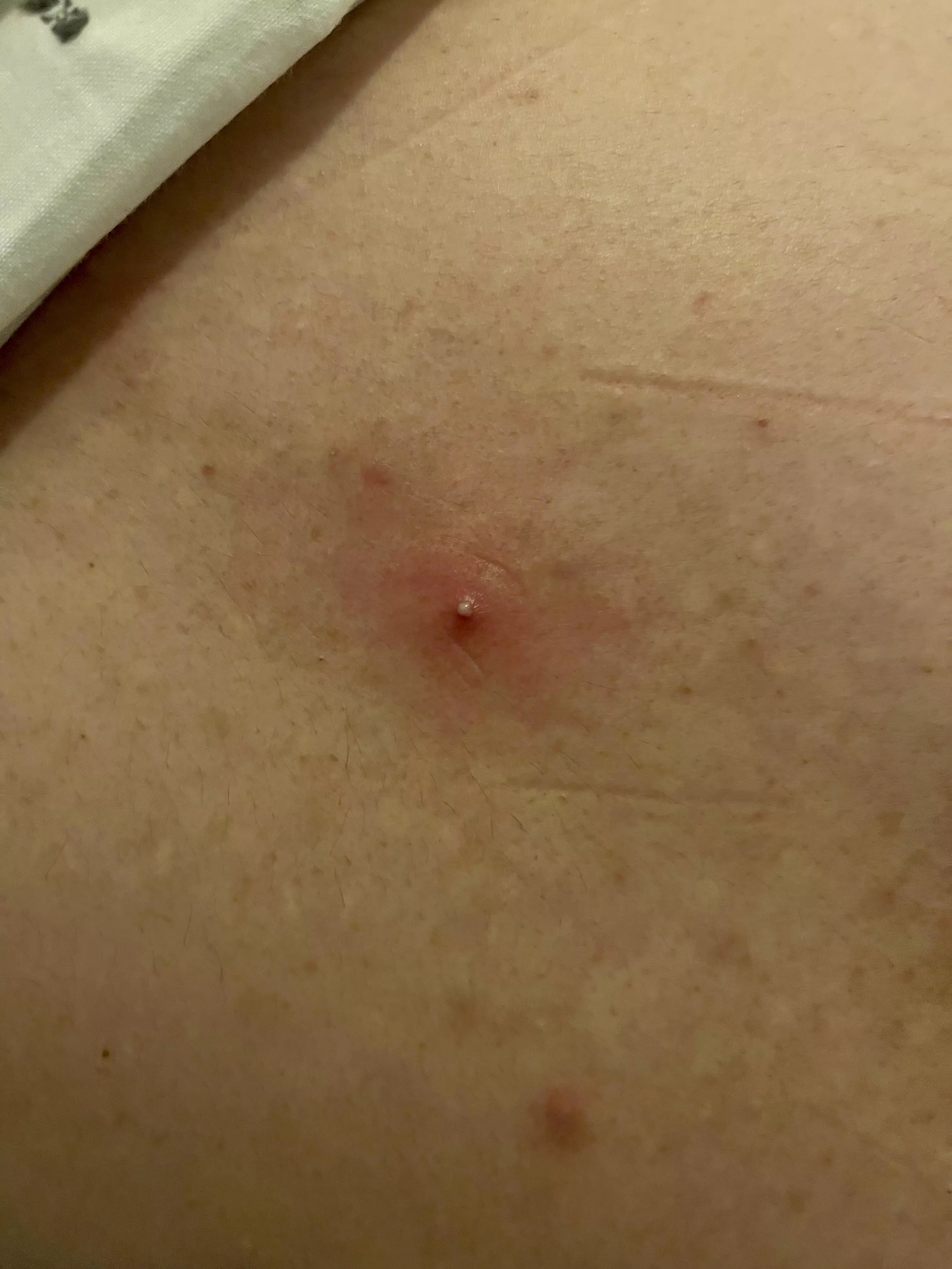 Long time lurker, first time poster.