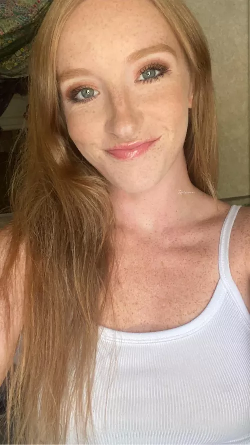 Would you kiss all my freckles