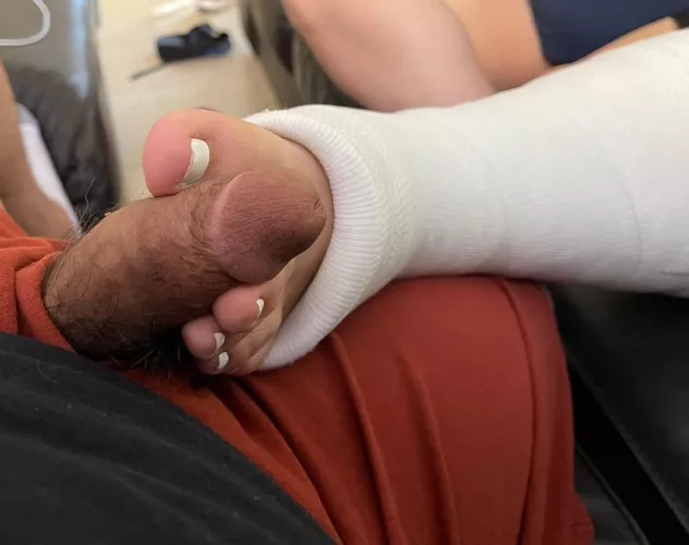 Her ankle might be broken, but her toes still work!