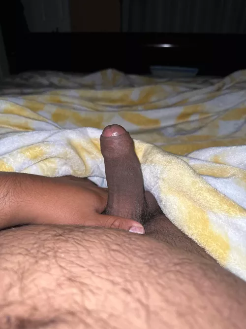 21 M in need of head