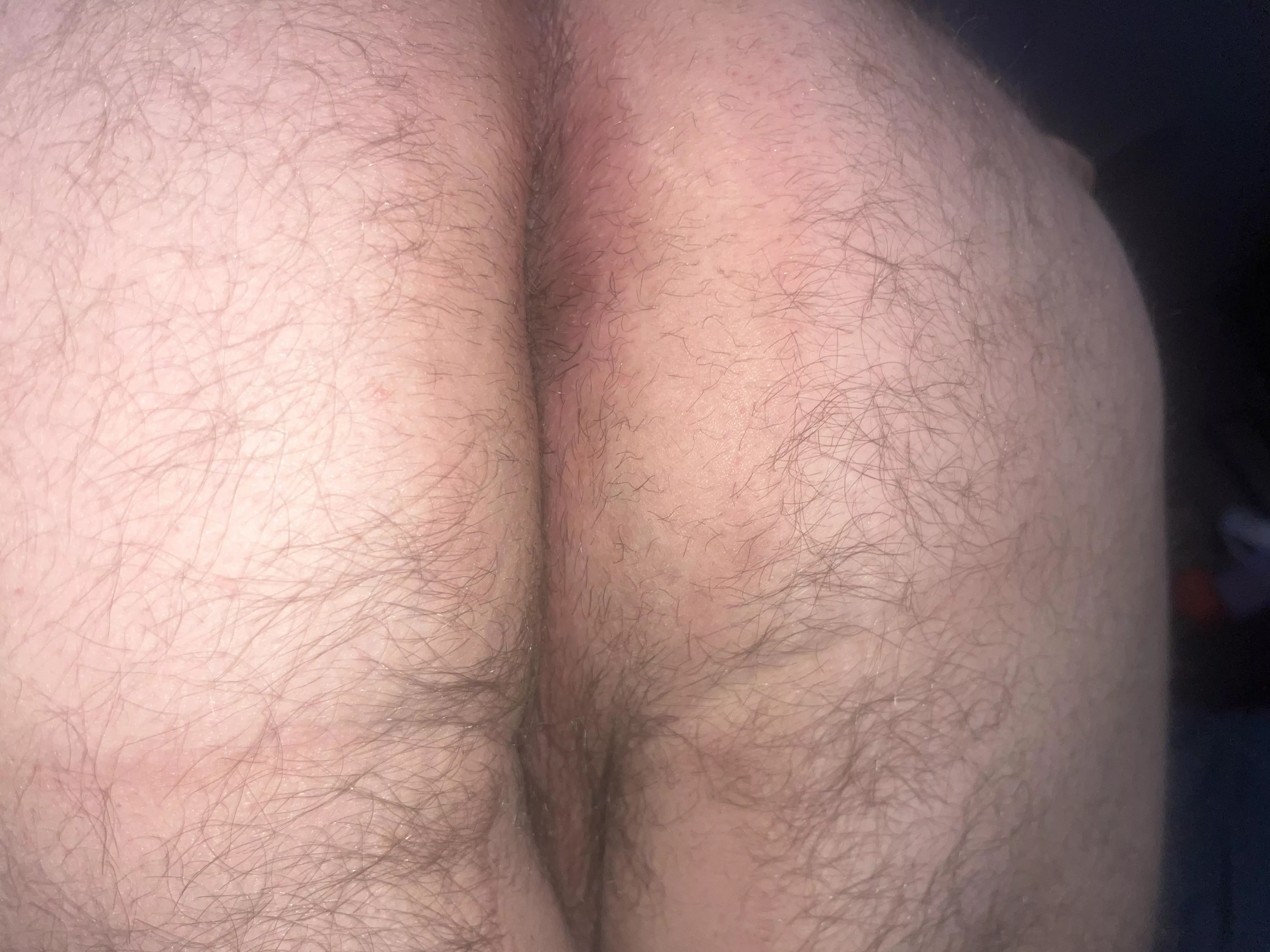 Do you mind giving it a kiss if it’s really hairy?