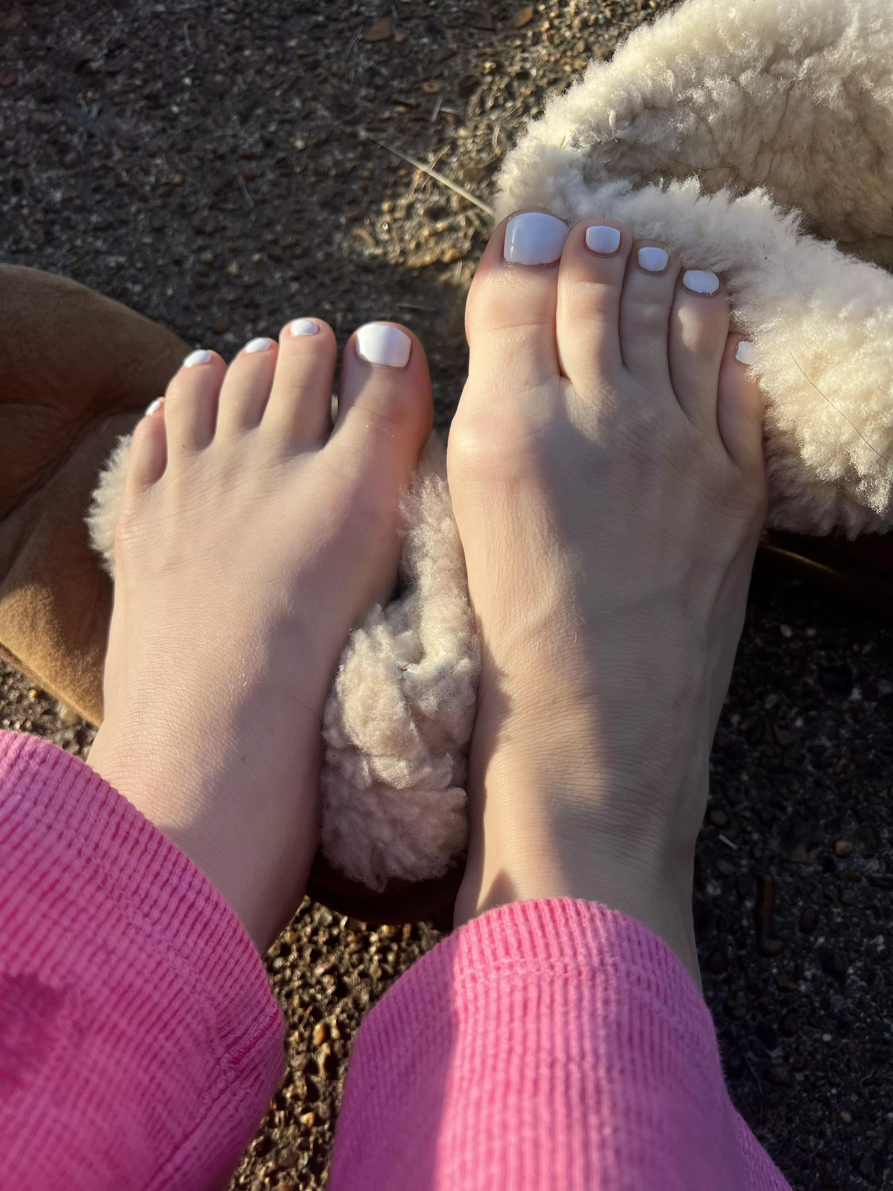 White toes on uggs ;)
