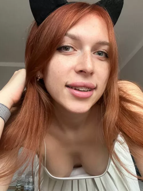 Would you kiss all my freckles