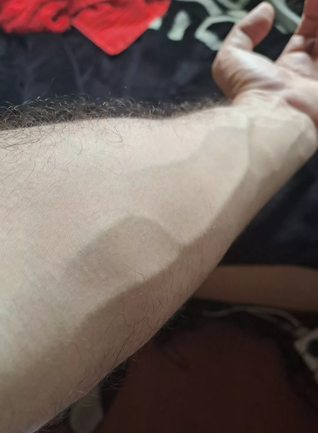 Sometimes my arm gets big veins