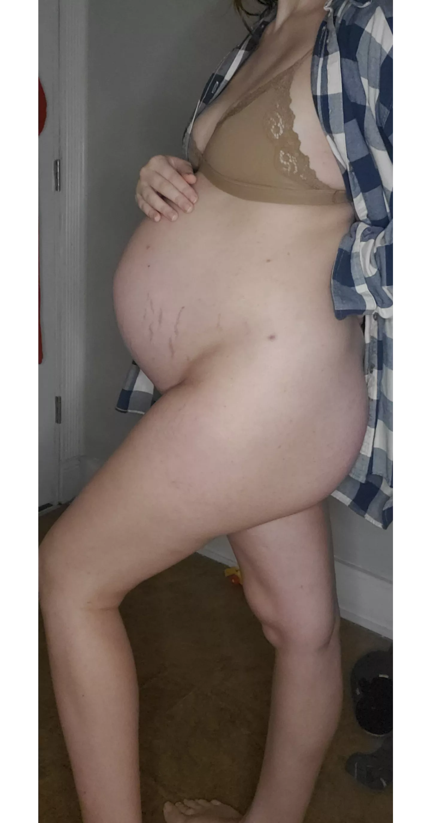 Do you agree stretchmarks are sexy?