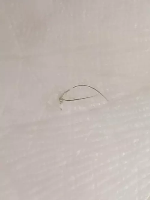 I found a bump on my armpit and squeezed it. This came out, skin side first. I think it's 5 hairs growing out of a piece of skin.