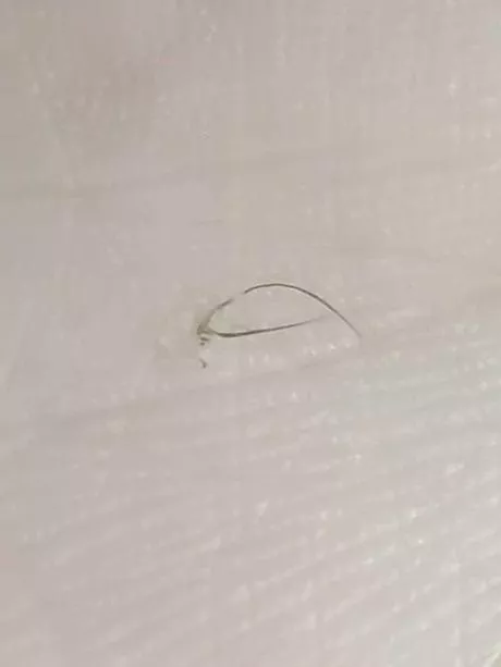 I found a bump on my armpit and squeezed it. This came out, skin side first. I think it's 5 hairs growing out of a piece of skin.