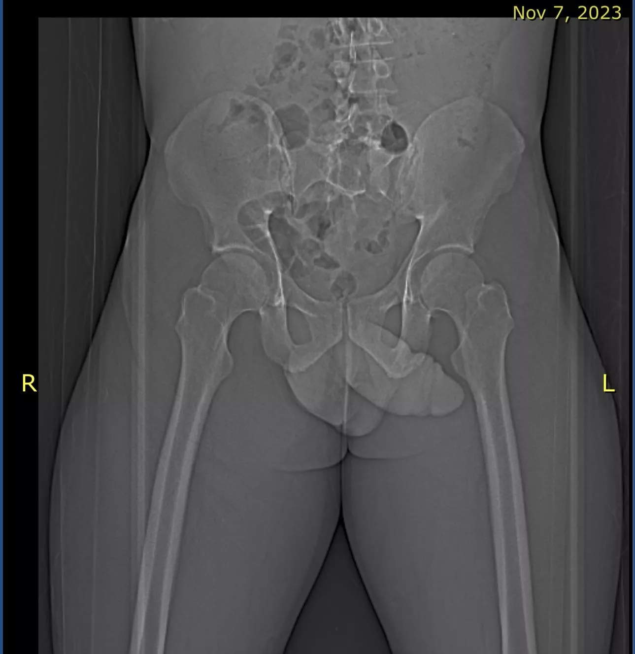 lol wonder what the person thought when he saw my image