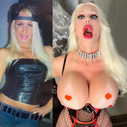 Should i get my lips bigger?