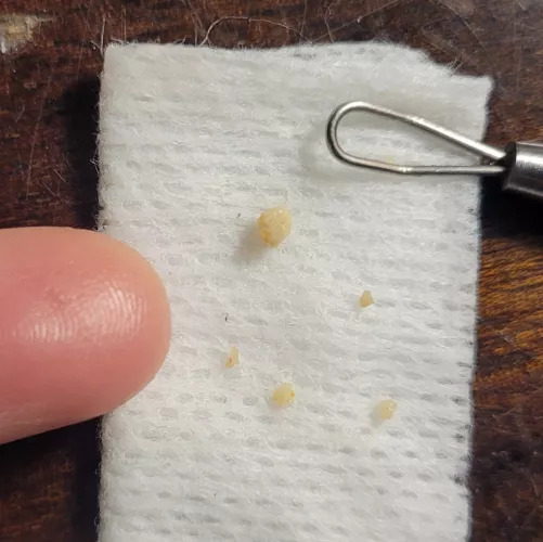 Small harvest of my little stones (I know I have more but my crypts are hard to reach)