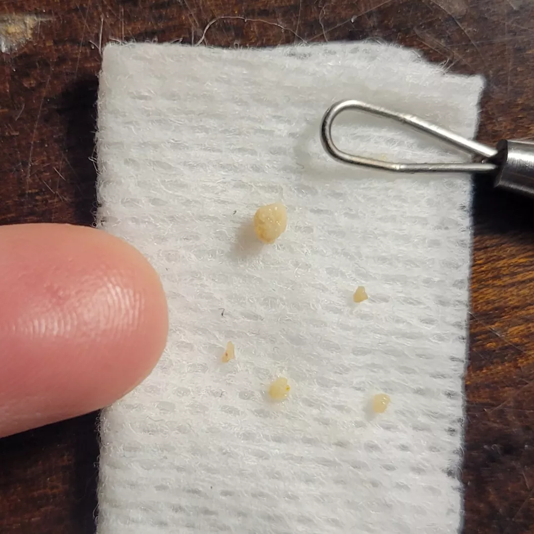 Small harvest of my little stones (I know I have more but my crypts are hard to reach)