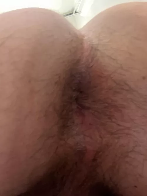 Always been self conscious about how hairy it is