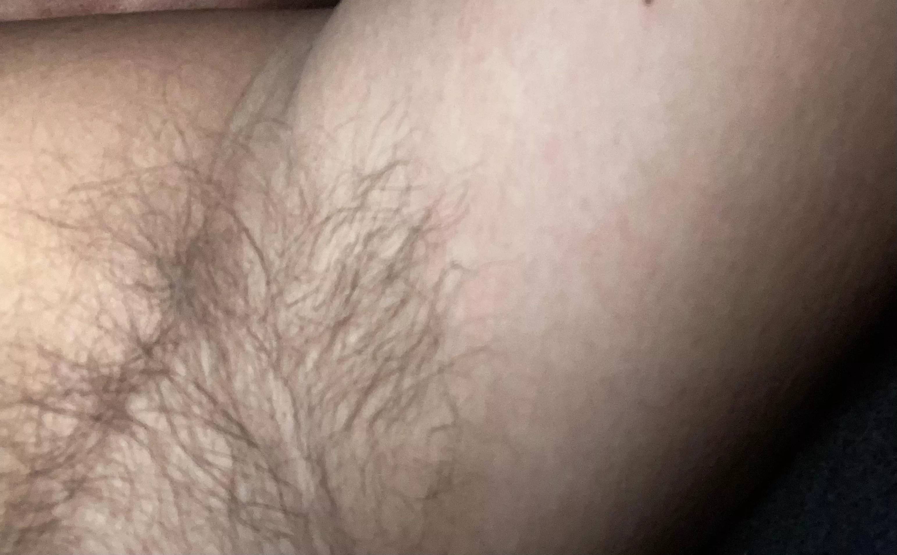 Hairy enough?