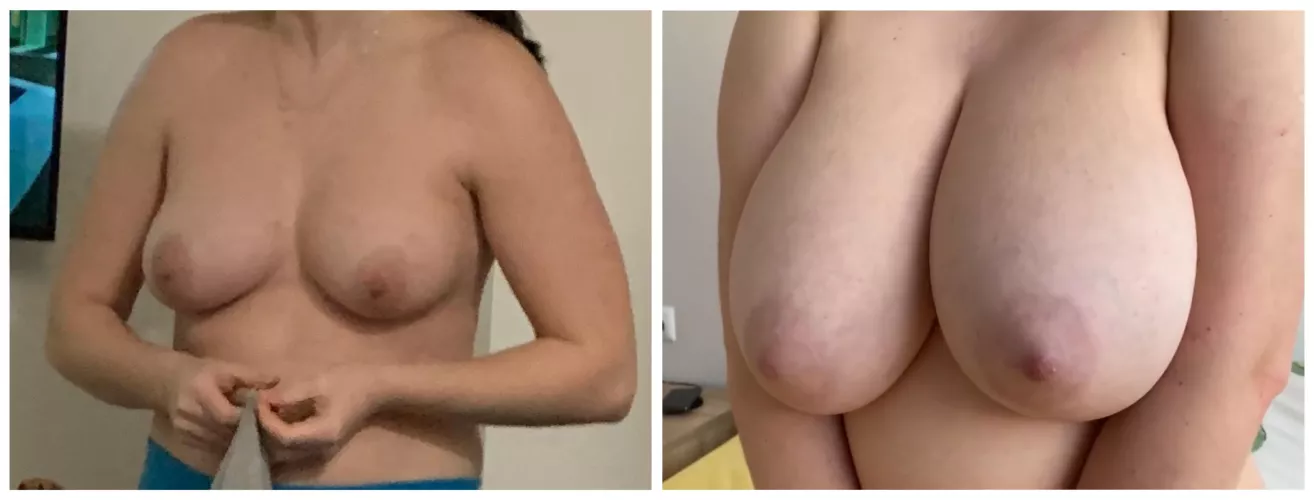 They won’t stop growing (20f)