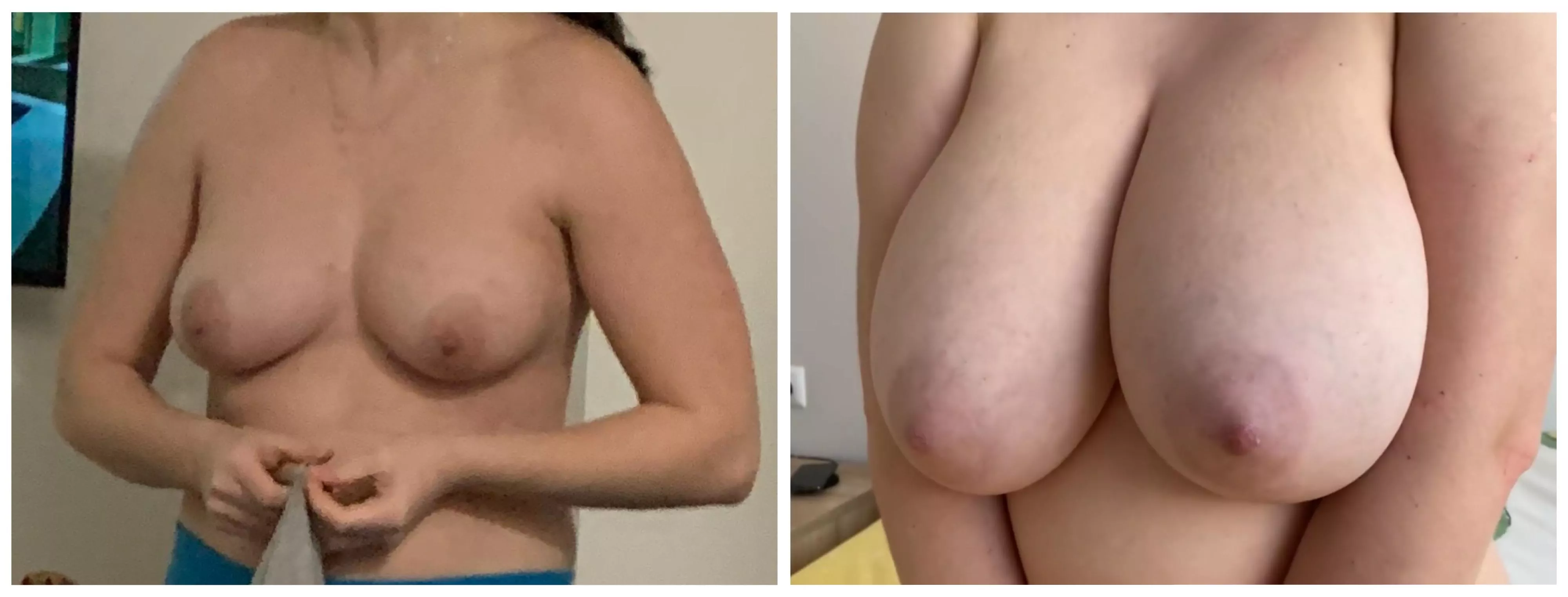 They won’t stop growing (20f)