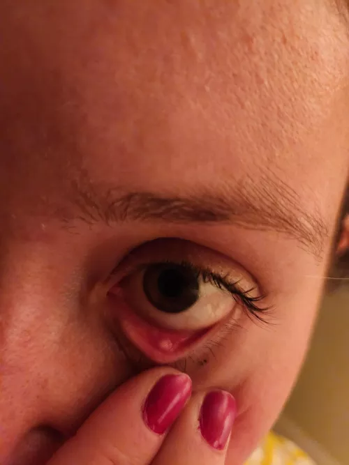 Forbidden eye pop. It hurts.