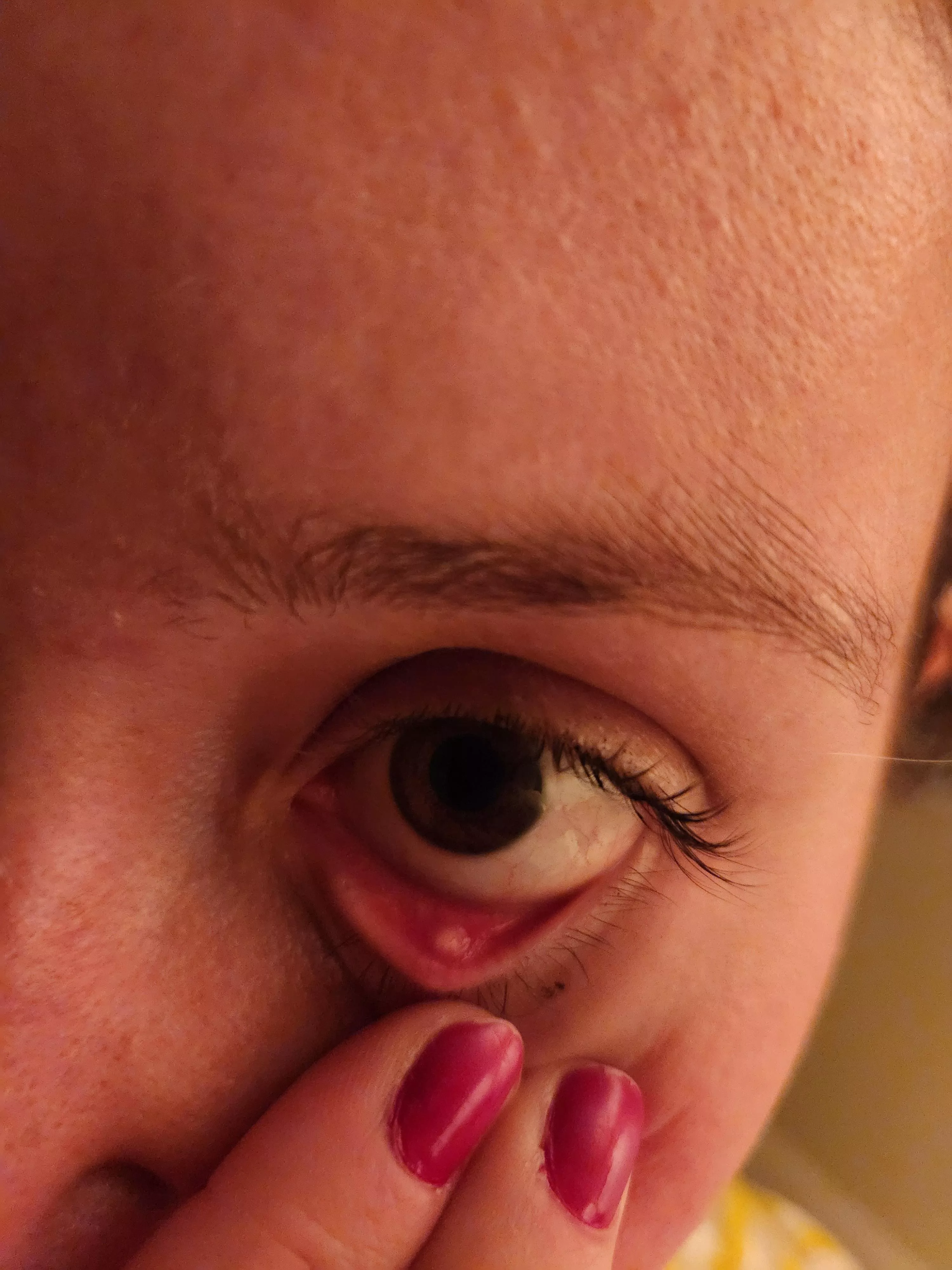 Forbidden eye pop. It hurts.