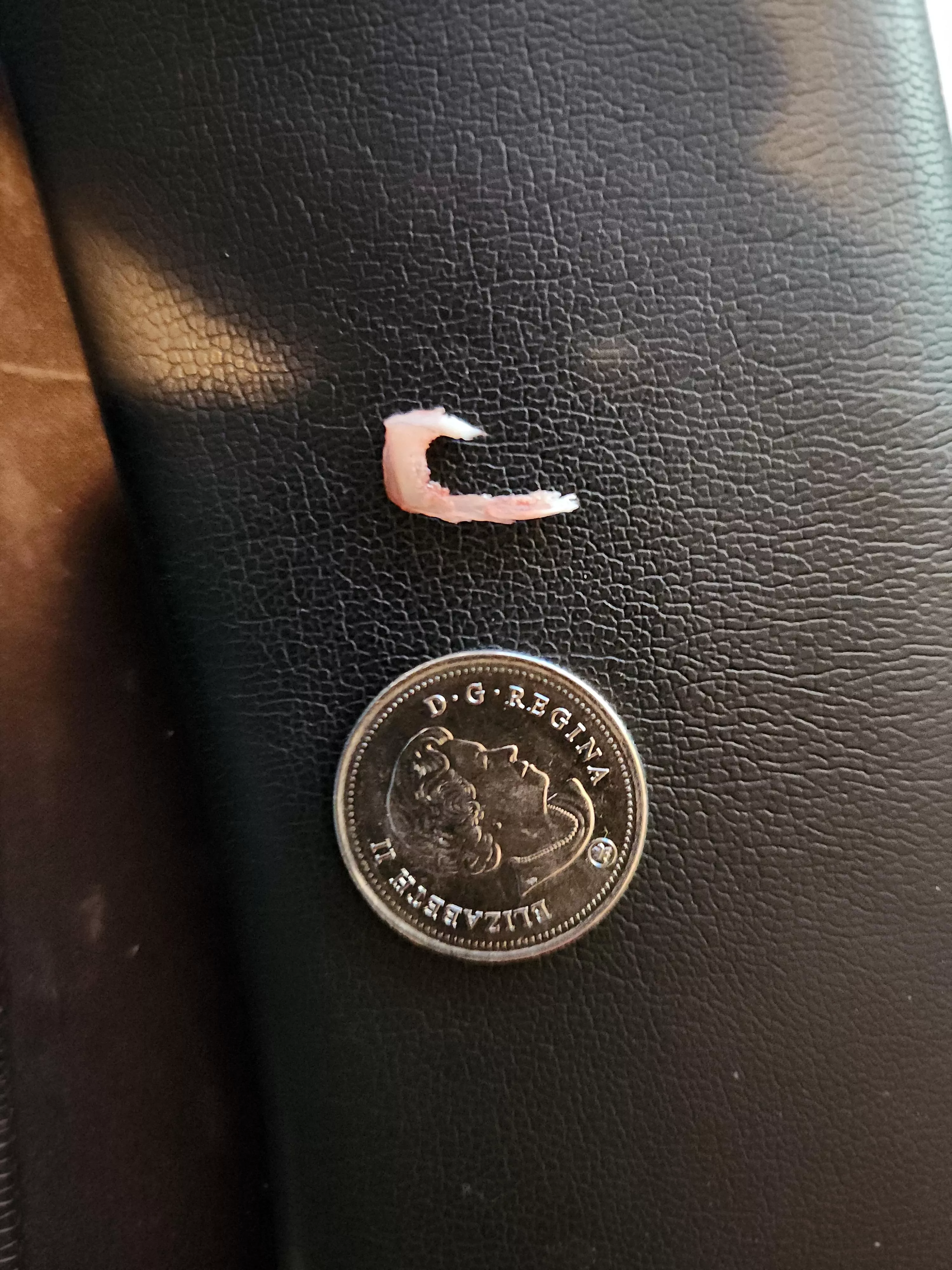 When you don't make a video but do a little ingrown work since your toe is sore.