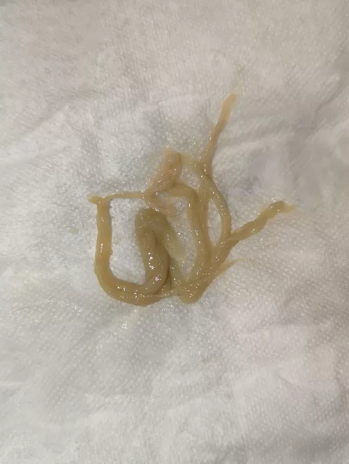 Just coughed up this lovely little nugget