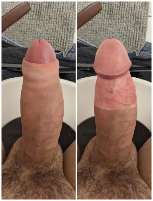 Let me know if you think I should get circumcised