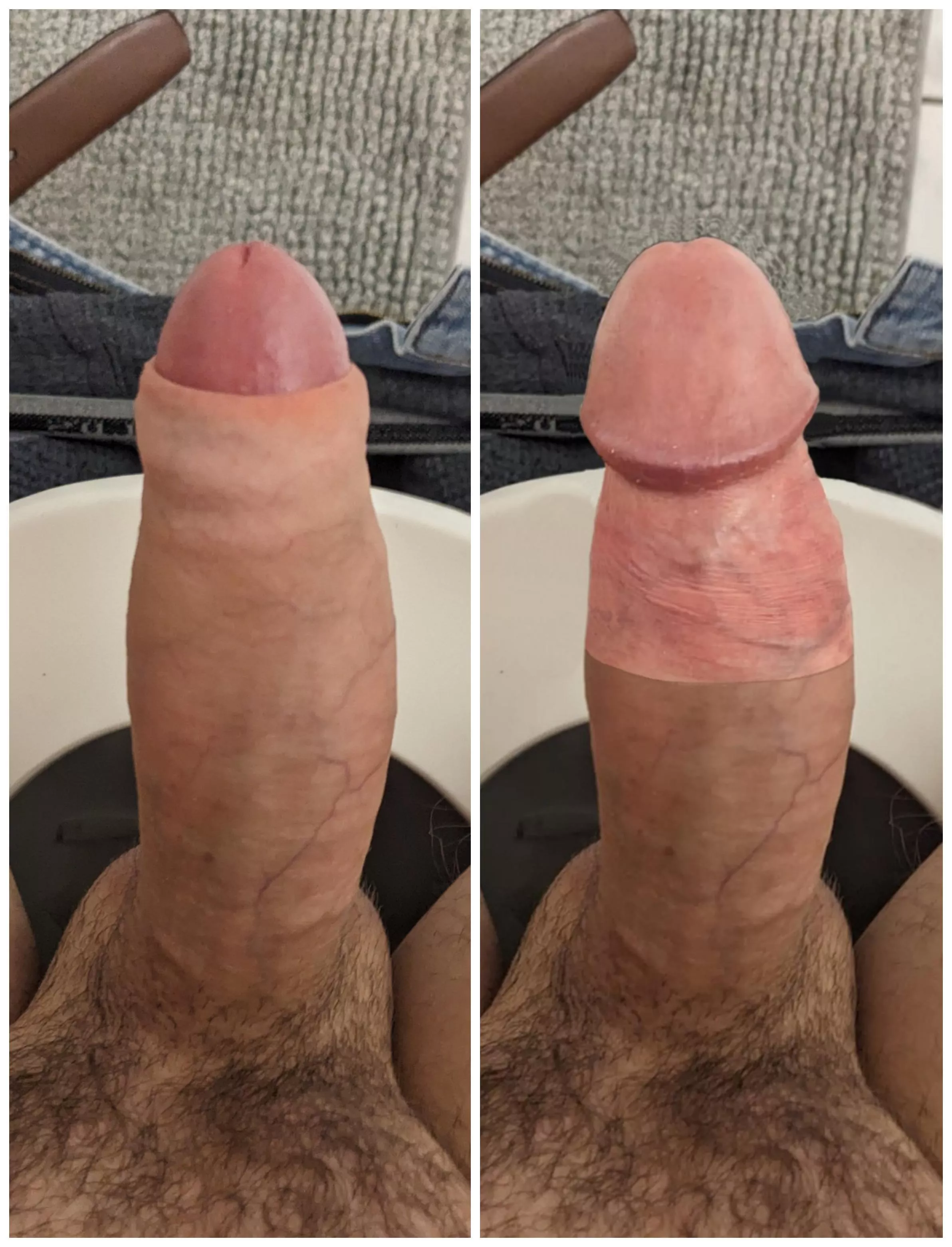 Let me know if you think I should get circumcised