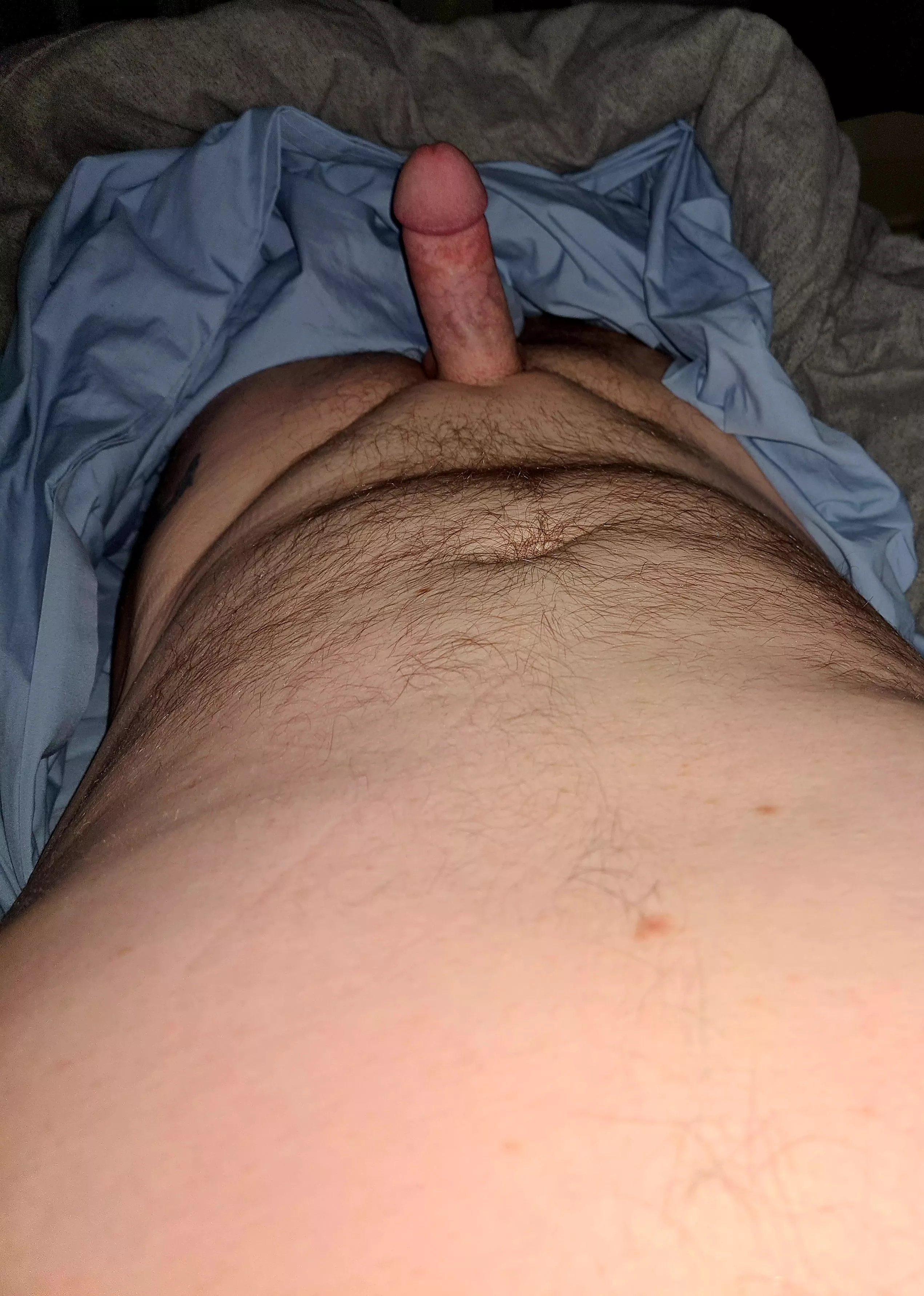 A little hard to rest [47]