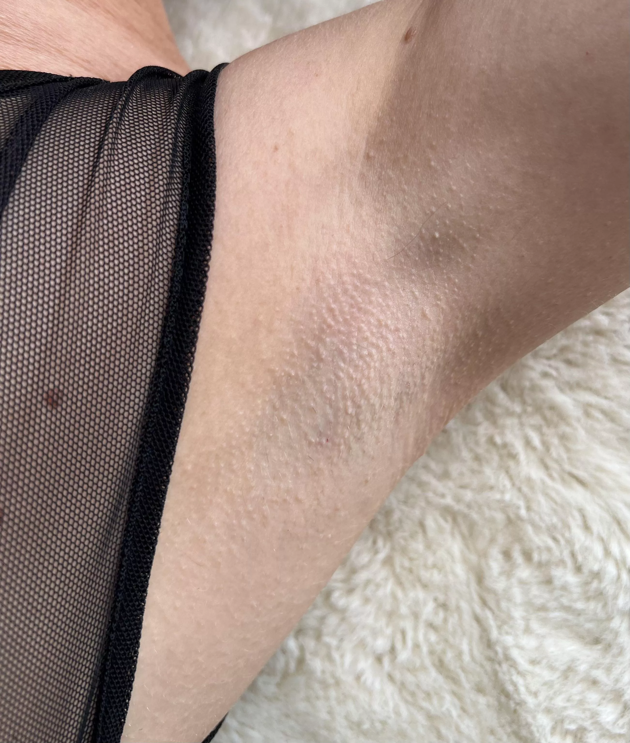 I have perfect armpits