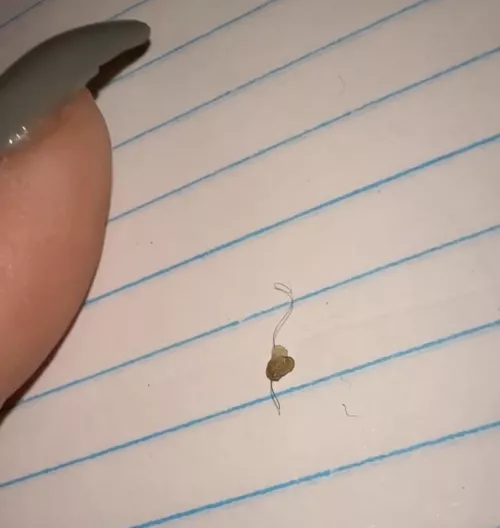 Mole…. Nope blackhead