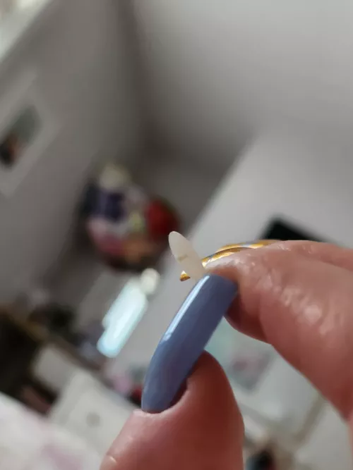 Pimple patch pulled out this little sprout