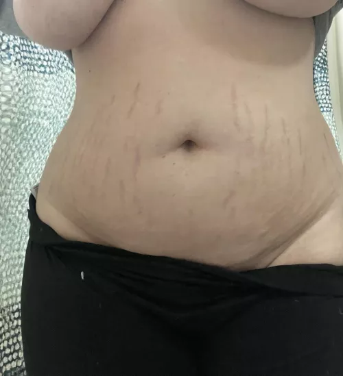 2024 is the year I stop being insecure about my stretch marks.