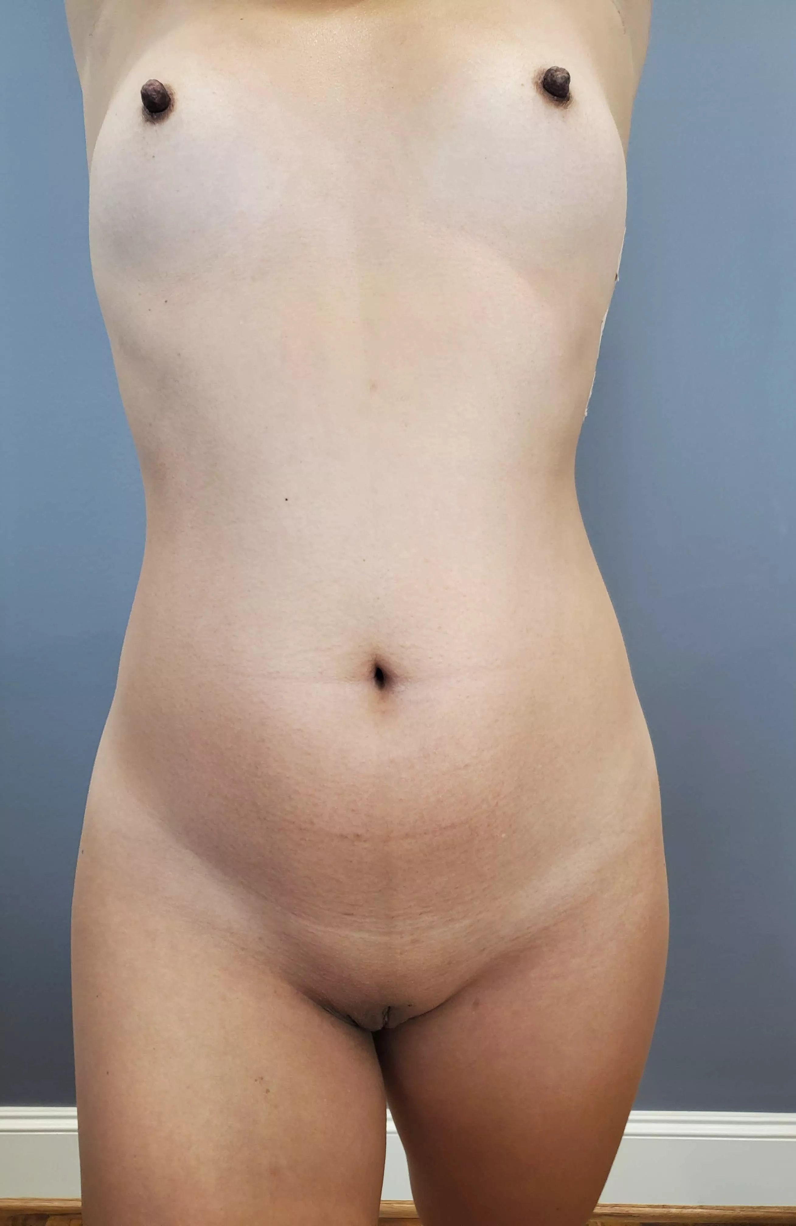 I used to be so insecure about my nipples, but now I try to flaunt them