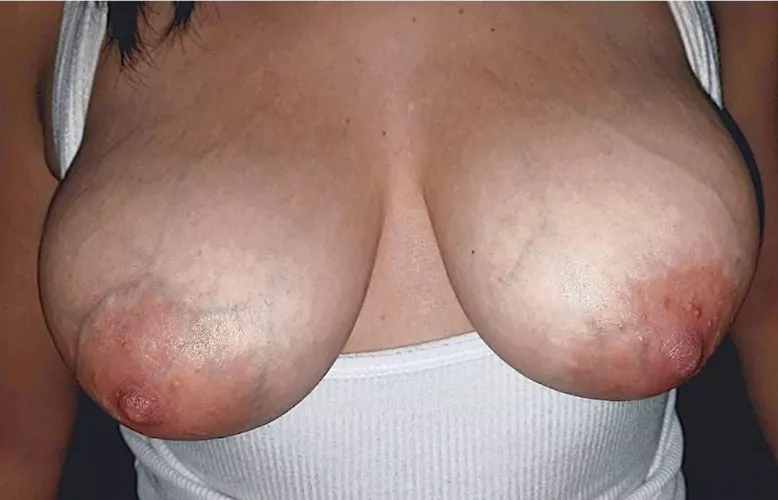 Love the veins showing through, enjoy the view