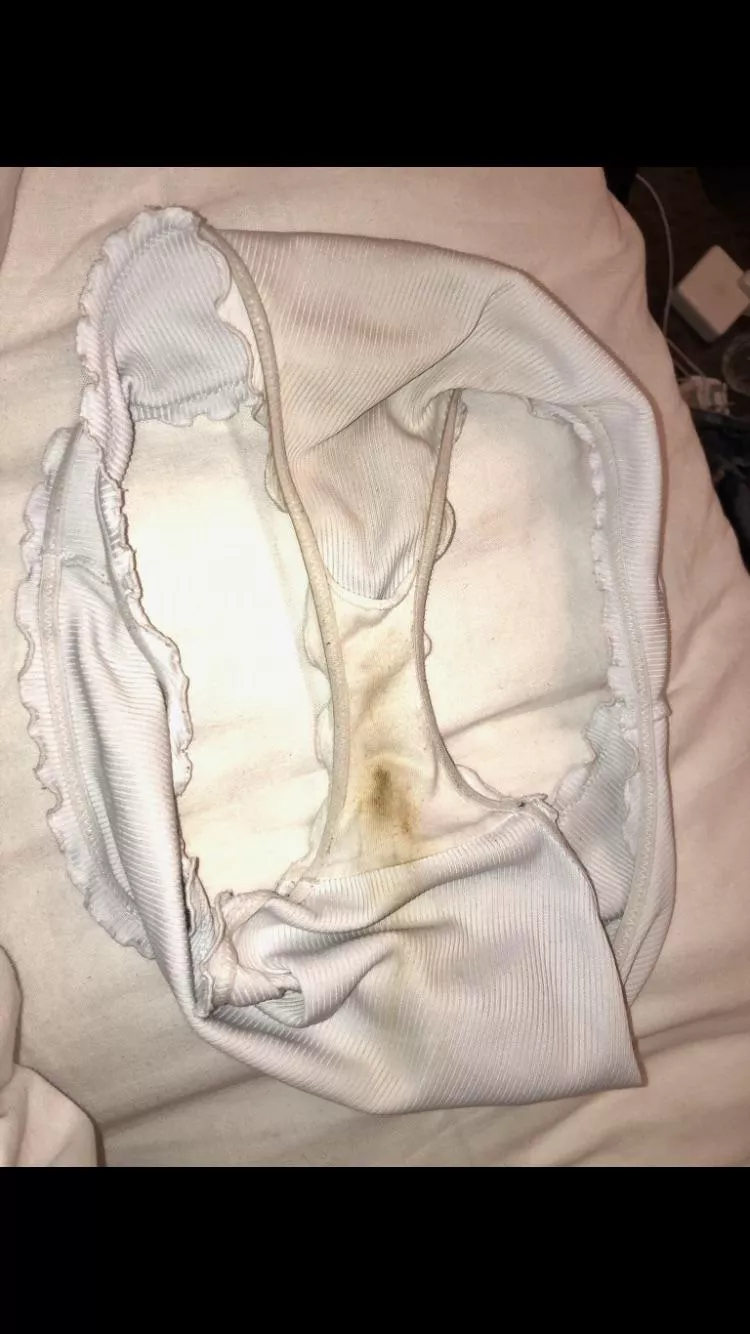 I’m getting skids after anal each night