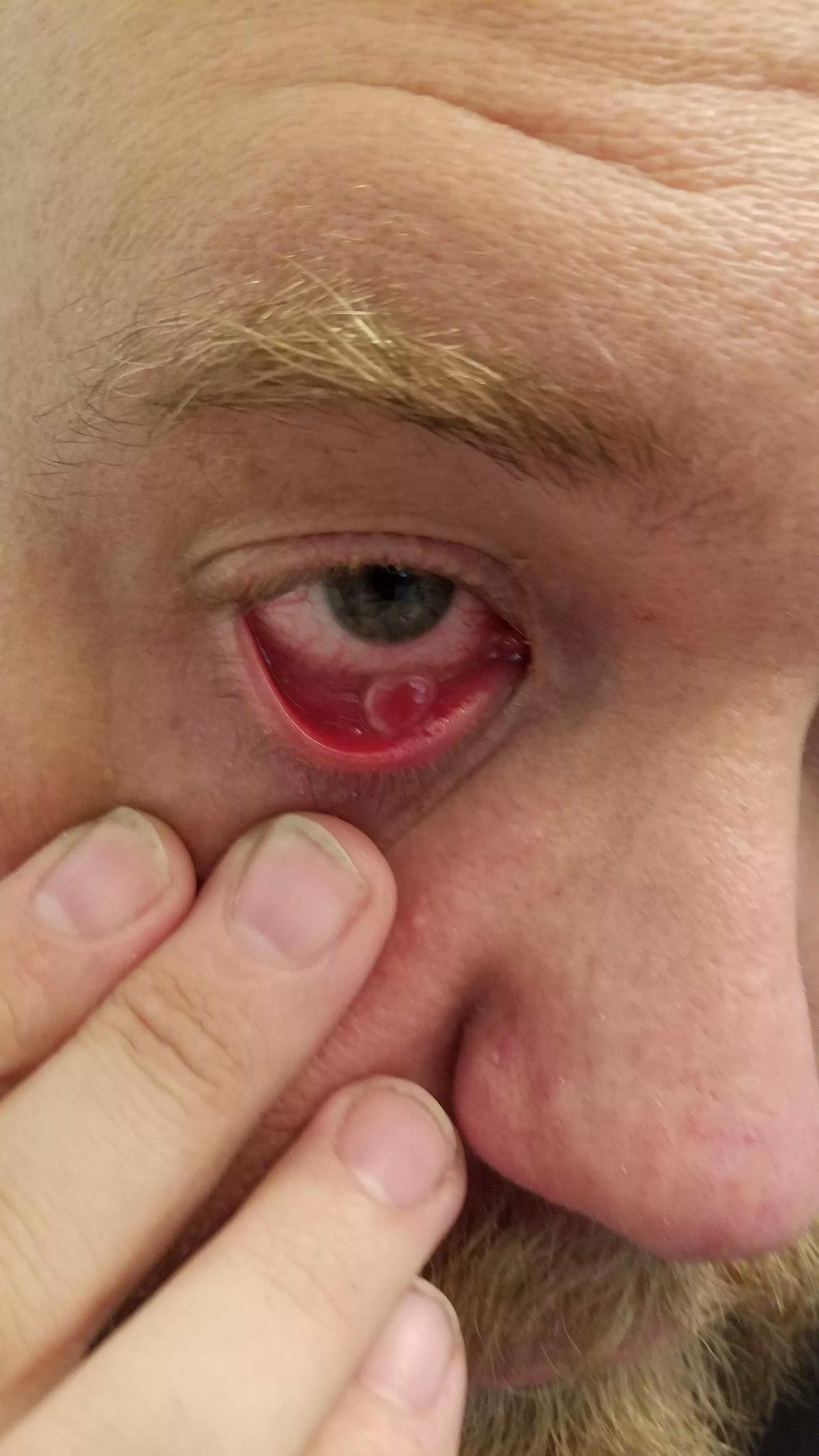 My husband just showed me this and I'm like get in the car we're going to urgent care... but not before I get a picture