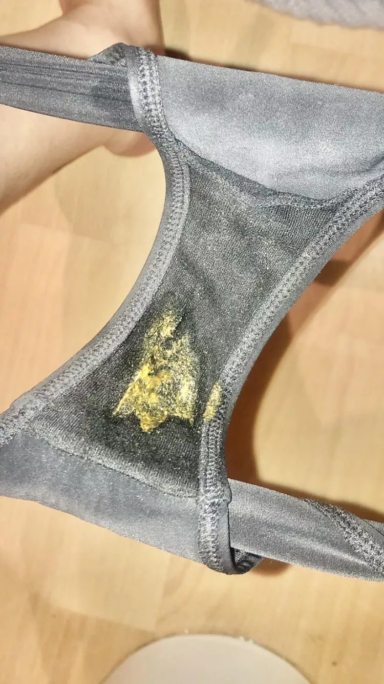 Such an incredible skid