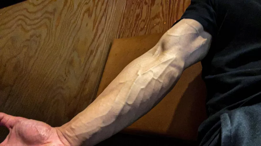 Who wants to trace my veins ?