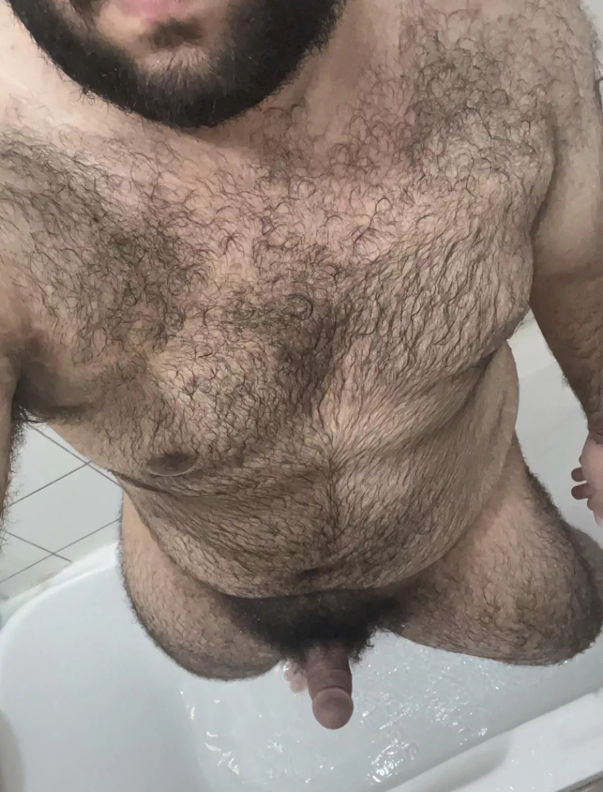Is it weird to be this hairy as a (20) years old?